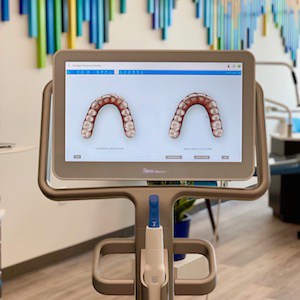 Digital models of teeth on computer monitor